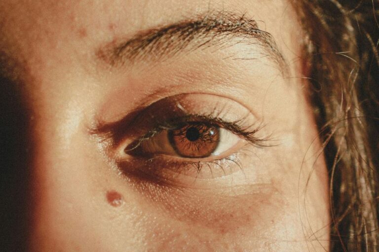 a close up image of a woman with a mole on her face