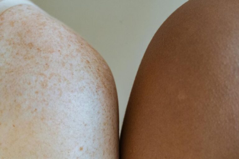 Photo by Angela Roma : https://www.pexels.com/photo/shoulders-of-multiracial-models-against-light-wall-7479999/
