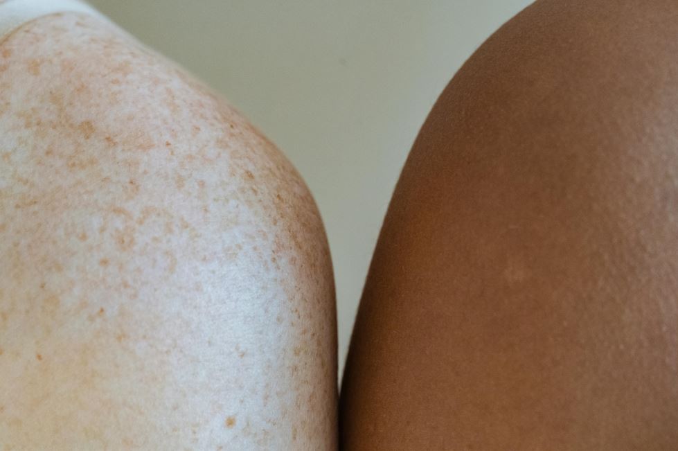Photo by Angela Roma : https://www.pexels.com/photo/shoulders-of-multiracial-models-against-light-wall-7479999/